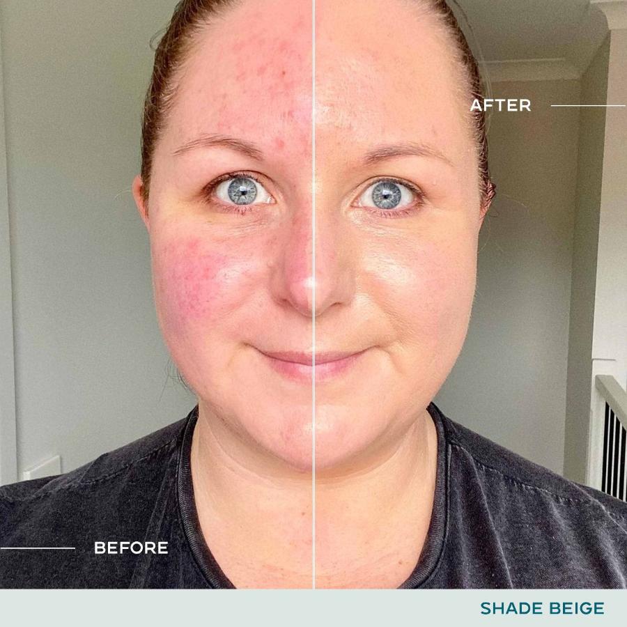 SPF + BB Cream