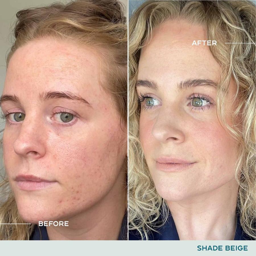 SPF + BB Cream